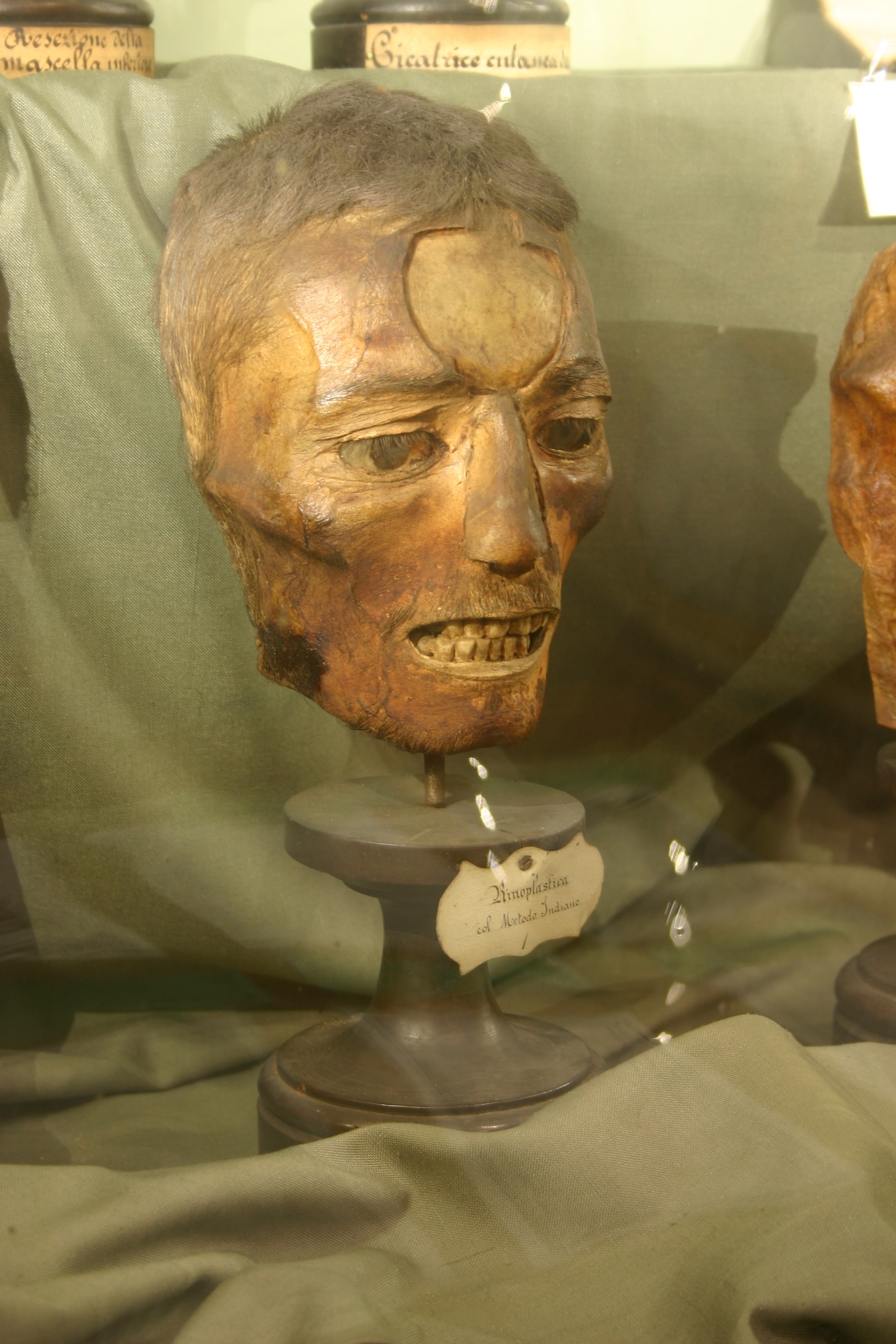 Rhinoplasty section of Luigi Porta anatomical collection, Museo per la Storia dell'Università, Pavia - 02.JPG
